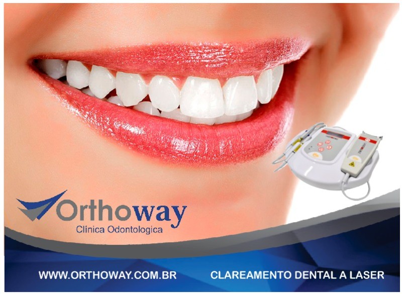 CLAREAMENTO DENTAL A LASER em Piracicaba | Orthoway Cl?nica